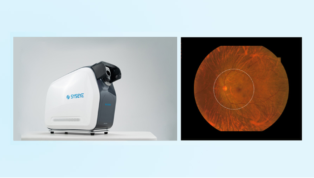 176° wide field fundus image example