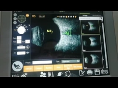 Résolution axiale superbe élevée ultrasonique de la machine 10MHz de scanner de fonction de calcul d'IOL