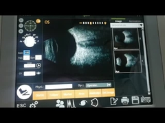 Examen vitreux électromagnétique de la maladie de corps de machine ultrasonique de scanner de B