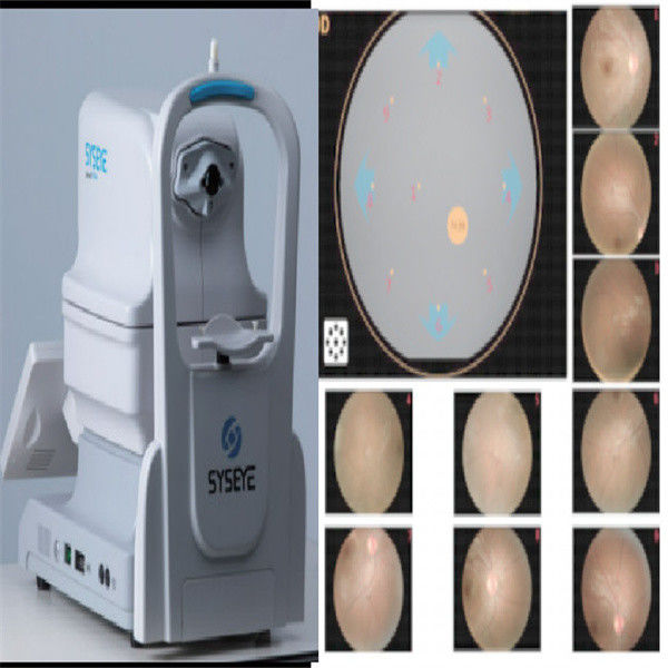 Caméra de fond d'œil non mydriatique à fonctionnement intelligent avec alignement automatique, champ de vision de 50° et taille minimale de pupille de 2,8 mm