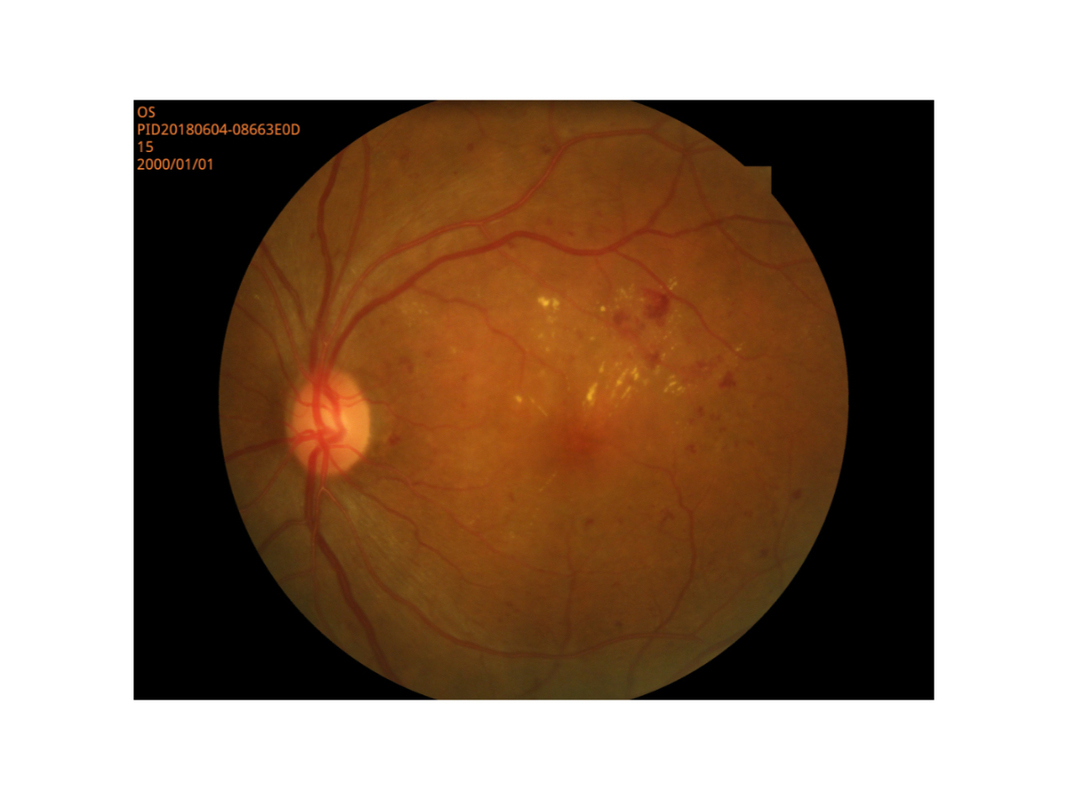 Petite haute résolution de mode d'élève de représentation de Digital de caméra rétinienne de fond