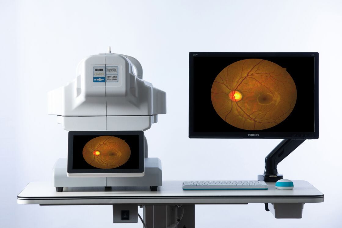 Non-Mydriatic Fundus Camera with 9-Position Mosaic Imaging, 50° Field of View, and 13 mm Working Distance for High-Quality Retinal Imaging